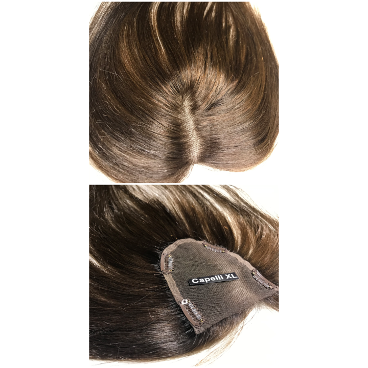 Toupet Closure N16L